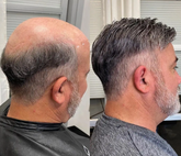 Ultra Thin Skin V-Loop Human Hair Prosthesis Toupee With 40% Grey Hair Replacement System Toupee For Men